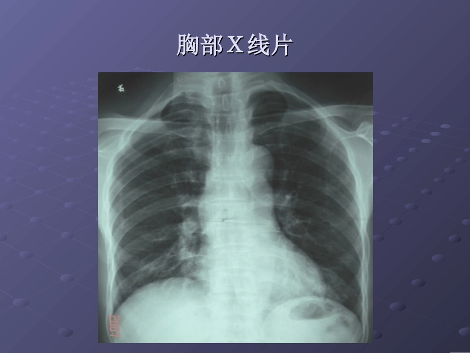 CAP教学查房2010_第2页