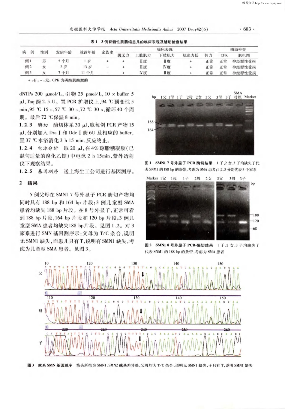 SMN基因诊断小儿脊髓性肌萎缩症_第2页