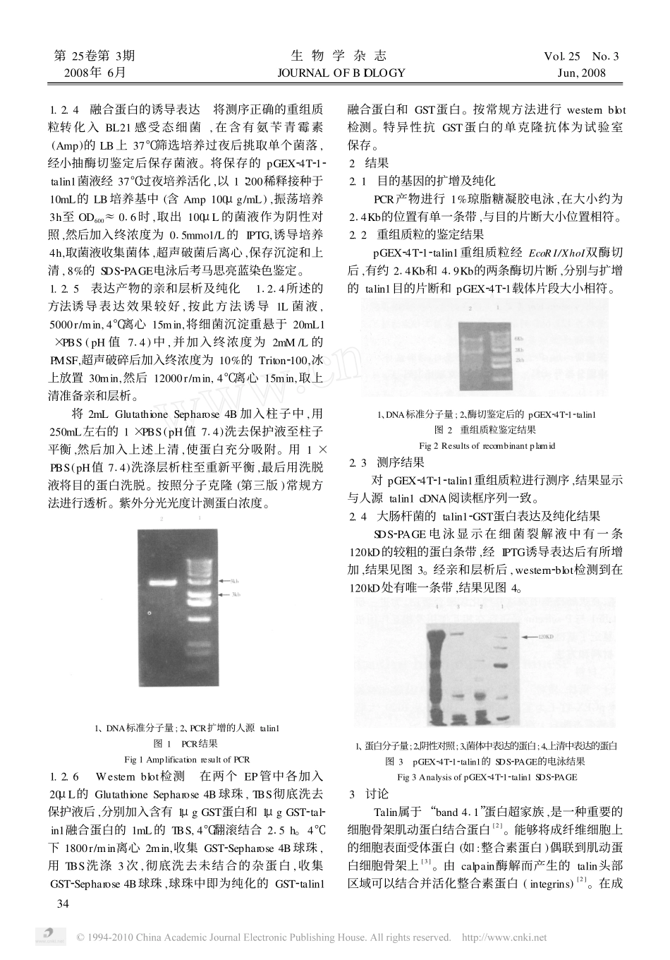 GST_talin1融合蛋白的原核表达及纯化_第2页
