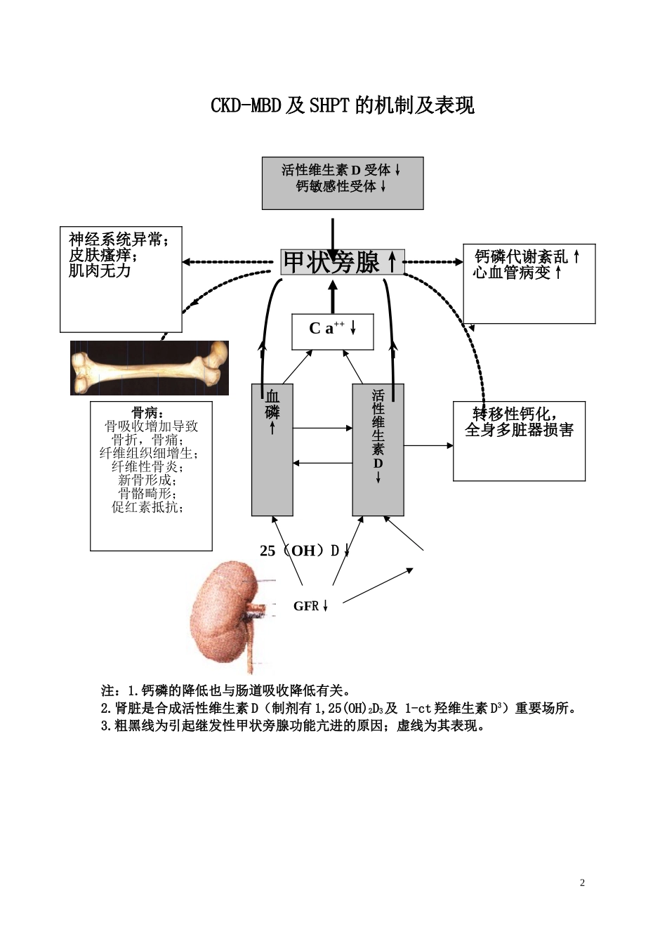 20110525肾性骨病及继发性甲状旁腺功能亢进_第2页