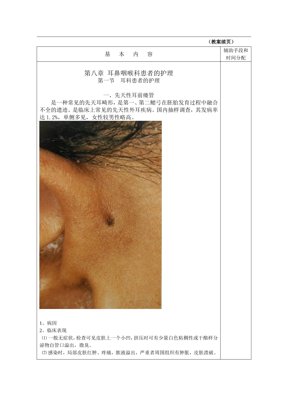 第八章  耳科患者的护理_第2页