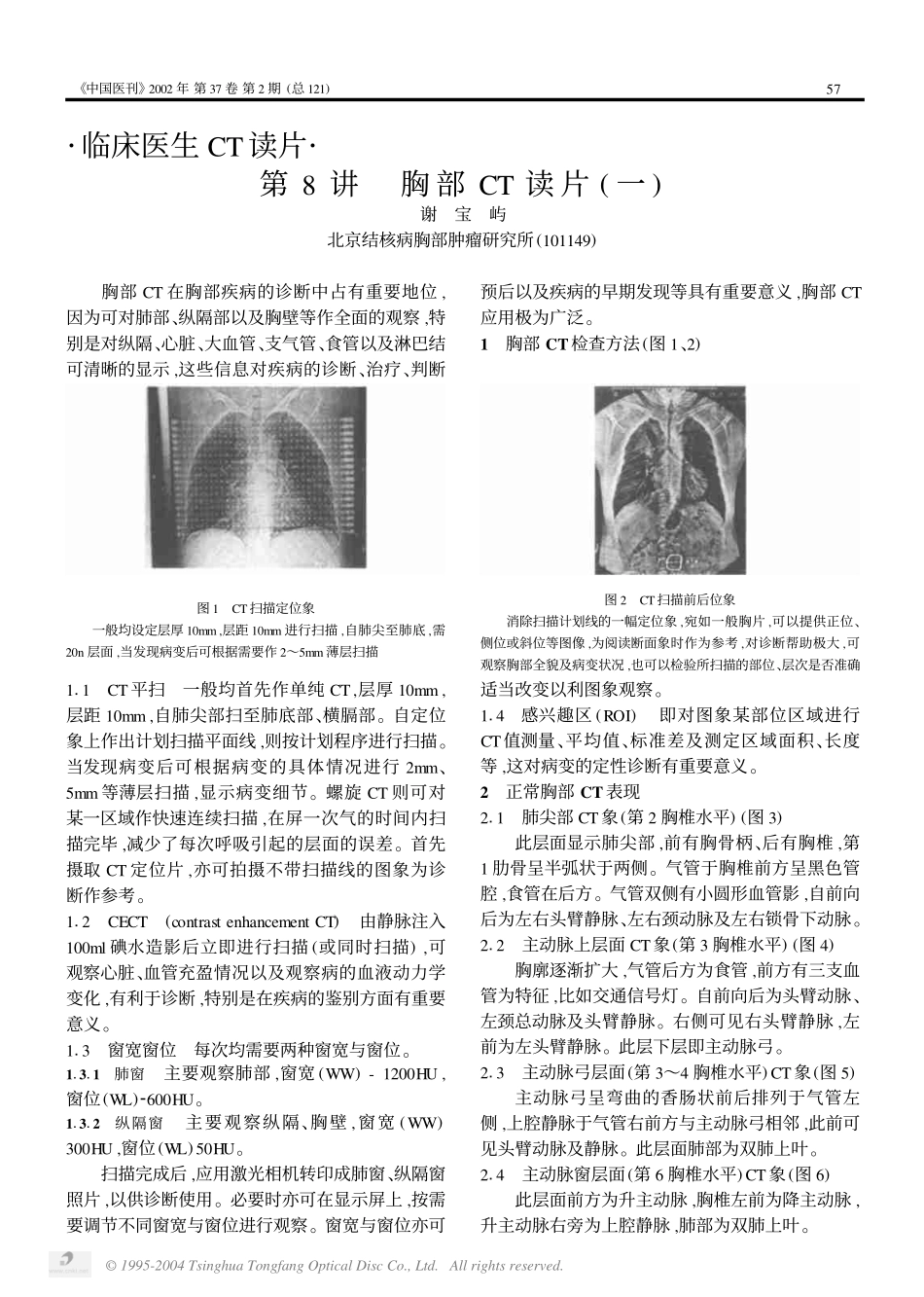 第8讲 胸部CT读片(一)_第1页