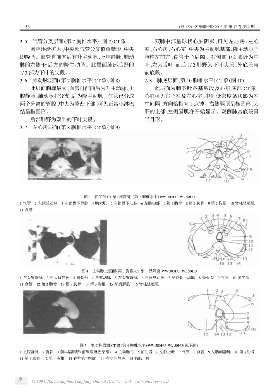 第8讲 胸部CT读片(一)_第2页