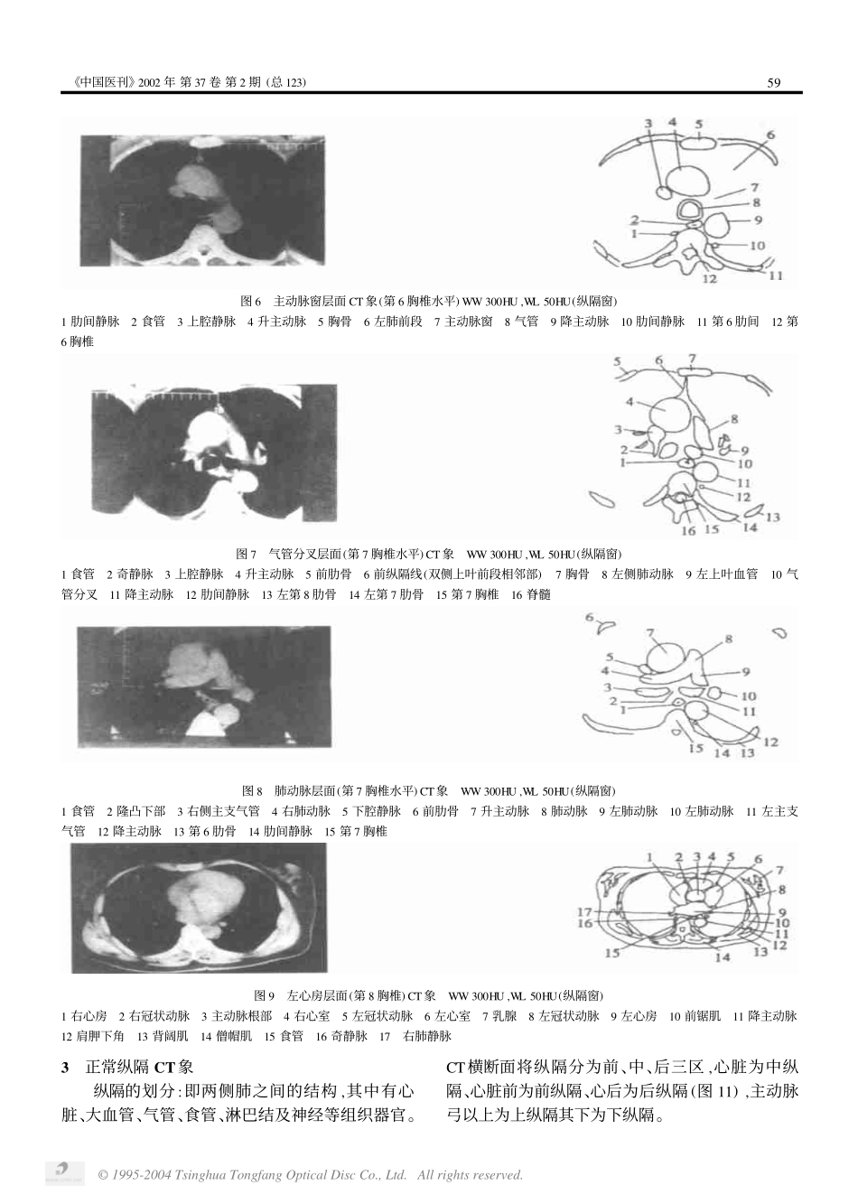 第8讲 胸部CT读片(一)_第3页