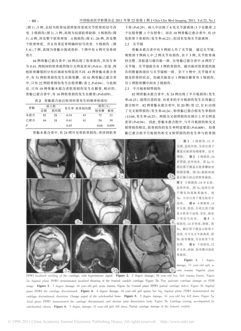 磁共振对青少年膝关节软骨损伤的诊断_第2页