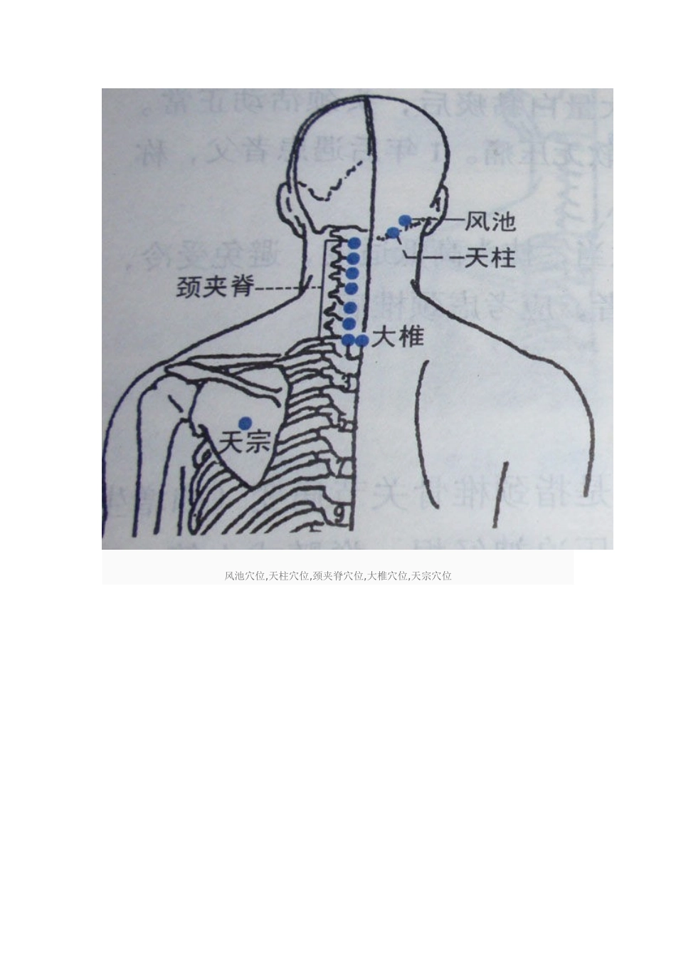 艾灸治疗颈椎病穴位图_第2页