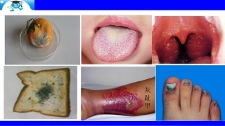 第五节人类对细菌和真菌的利用