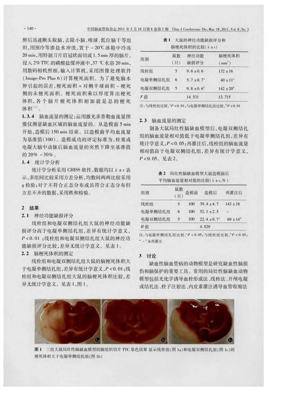 大鼠局灶性脑缺血模型制备方法的比较_第3页
