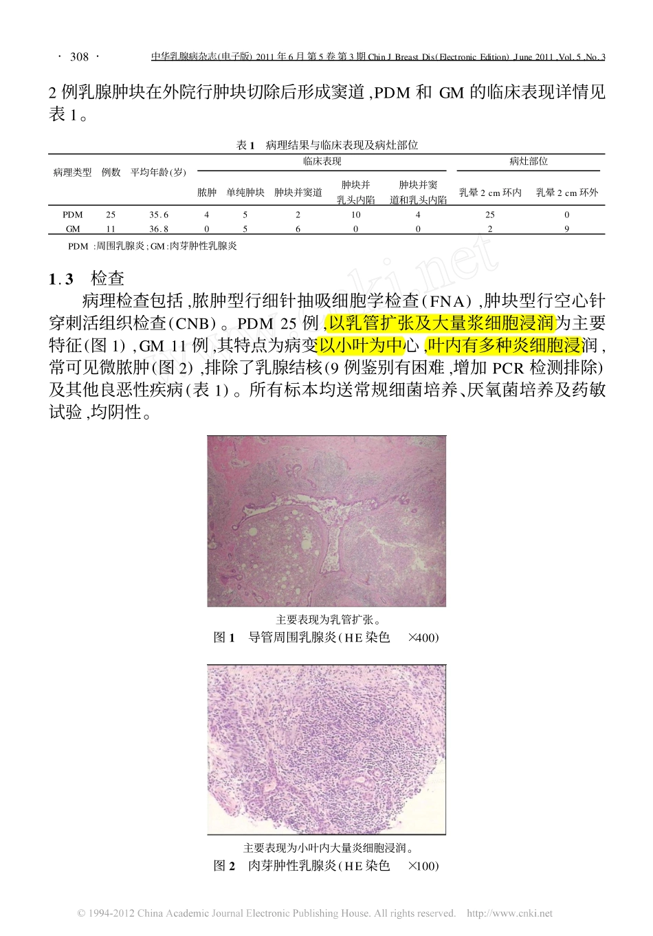 导管周围乳腺炎与肉芽肿性乳腺炎的临床鉴别与处理(2011 中华乳腺病杂志)_第3页