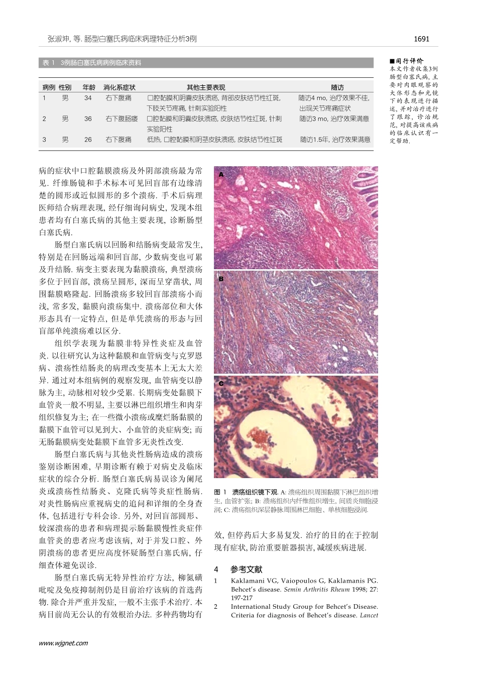 肠型白塞氏病临床病理特征分析3例_第3页