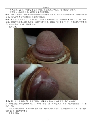 包皮环切(患者图文解说)
