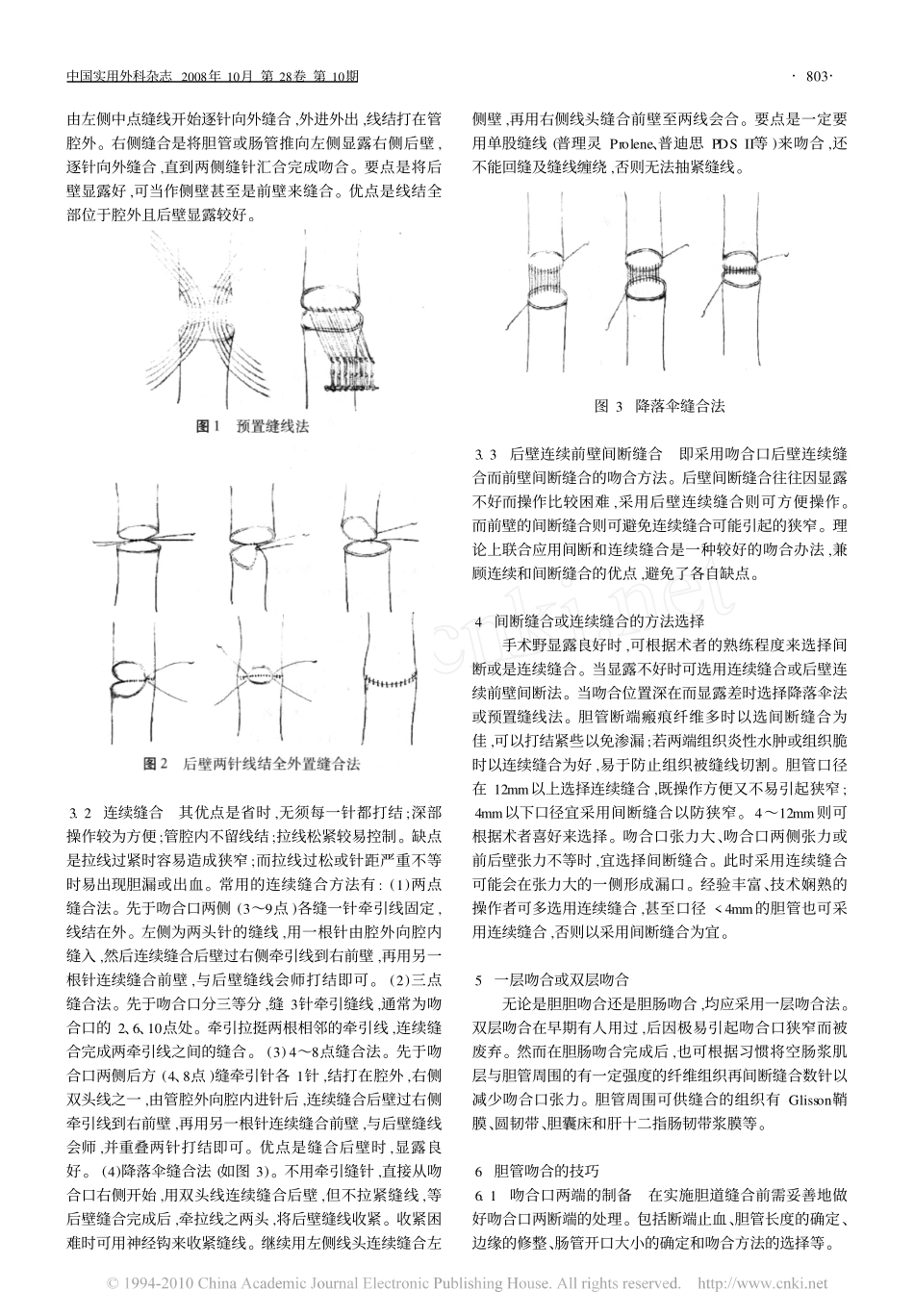 胆道手术中缝合  吻合技术和材料选择专家共识_2008__第2页
