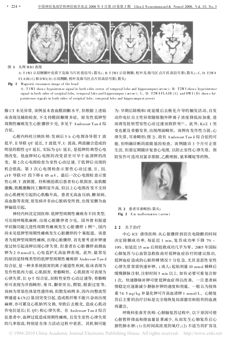 低钾性瘫痪合并心脏骤停_第2页