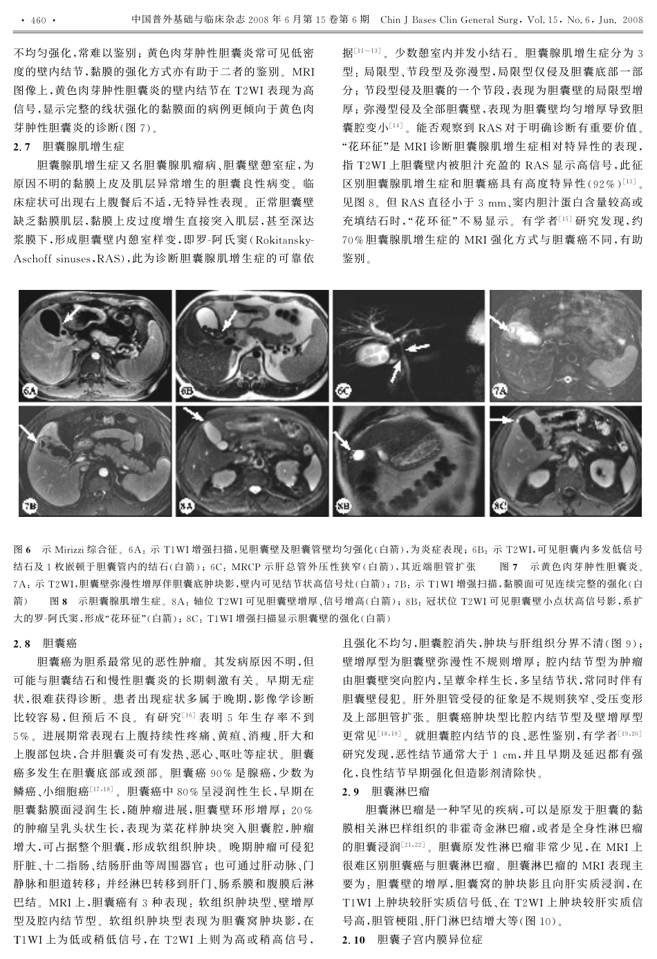 胆囊的MRI评价_第3页