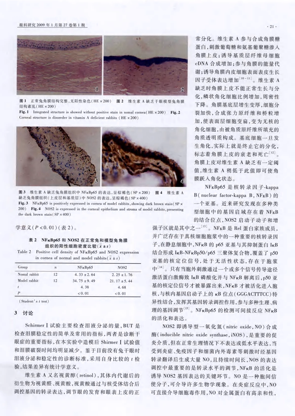 wwNFKBp65、NOS2在维生素A缺乏干眼模型兔角膜中 的表达及意义_第3页