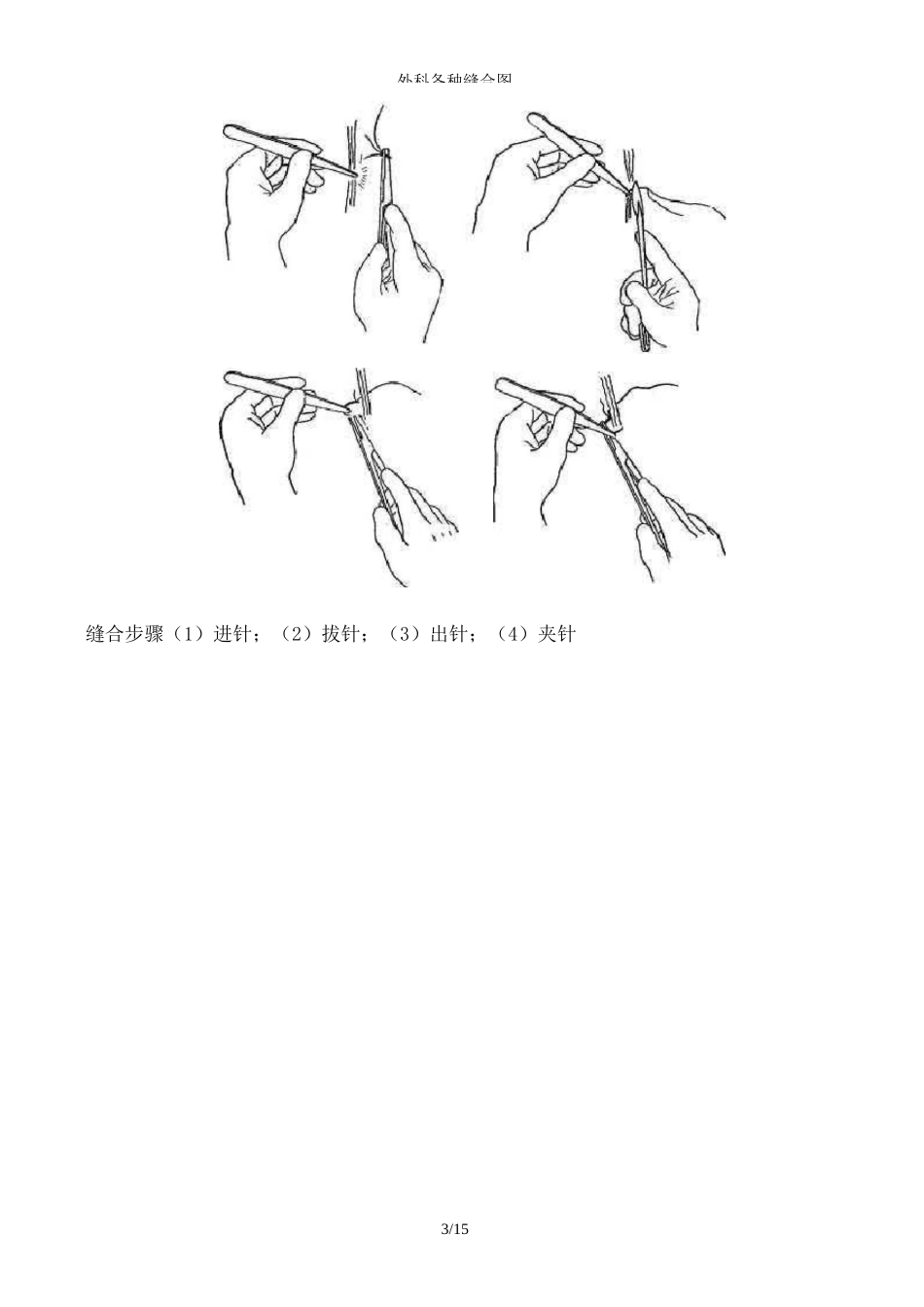 外科各种缝合图解_第3页