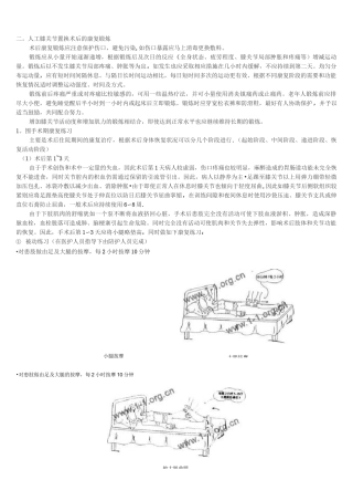 (完整版)膝关节置换手术术后康复指南