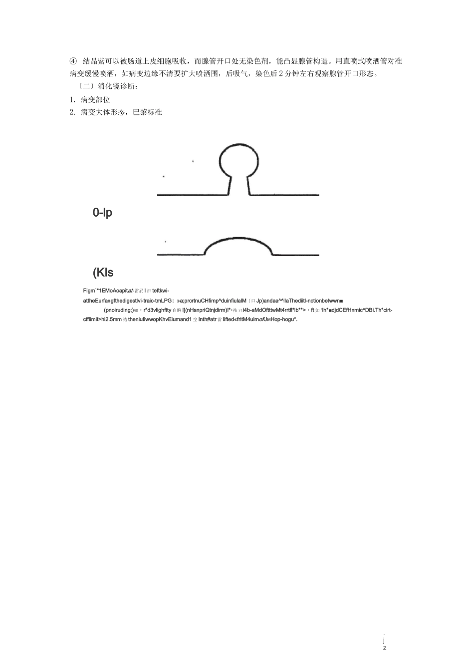 消化道早癌诊治规范_第2页