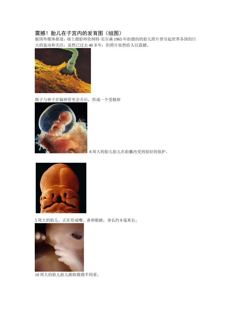 胎儿在子宫内的发育图_第1页