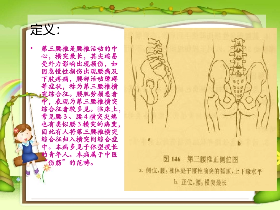 腰3横突综合症1_第2页