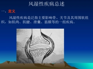 风湿性疾病总述