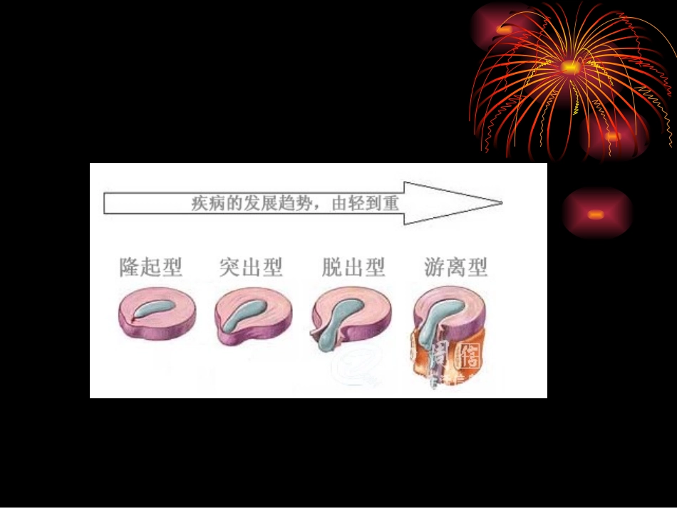 项痹、腰痛-2_第3页