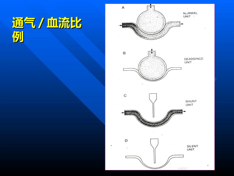 血气分析常用指标._第3页
