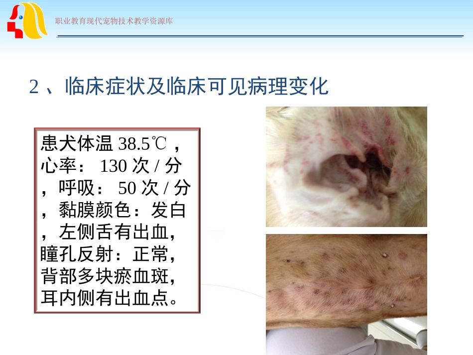 血小板减少症病例分析_第3页