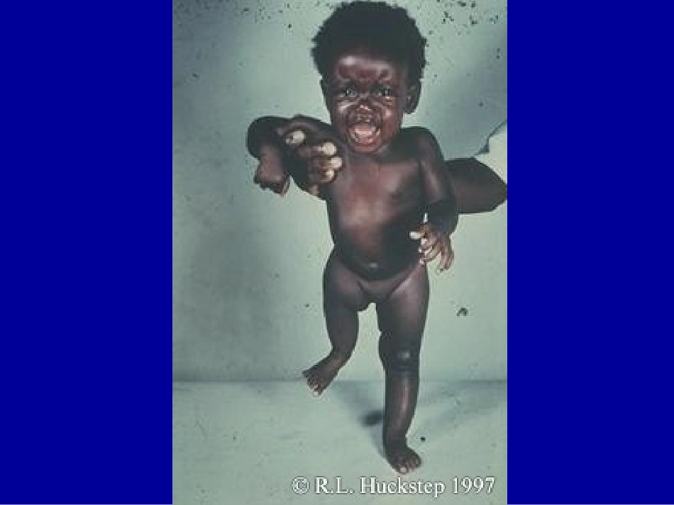 药品安全性监测范畴和应用_第3页