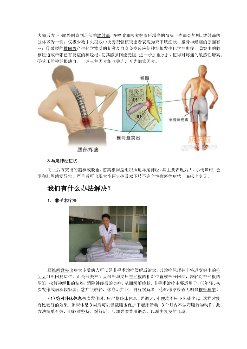 腰椎间盘突出症科普_第2页