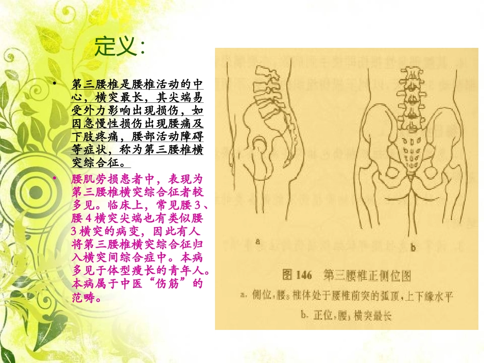 腰3横突综合症_第2页