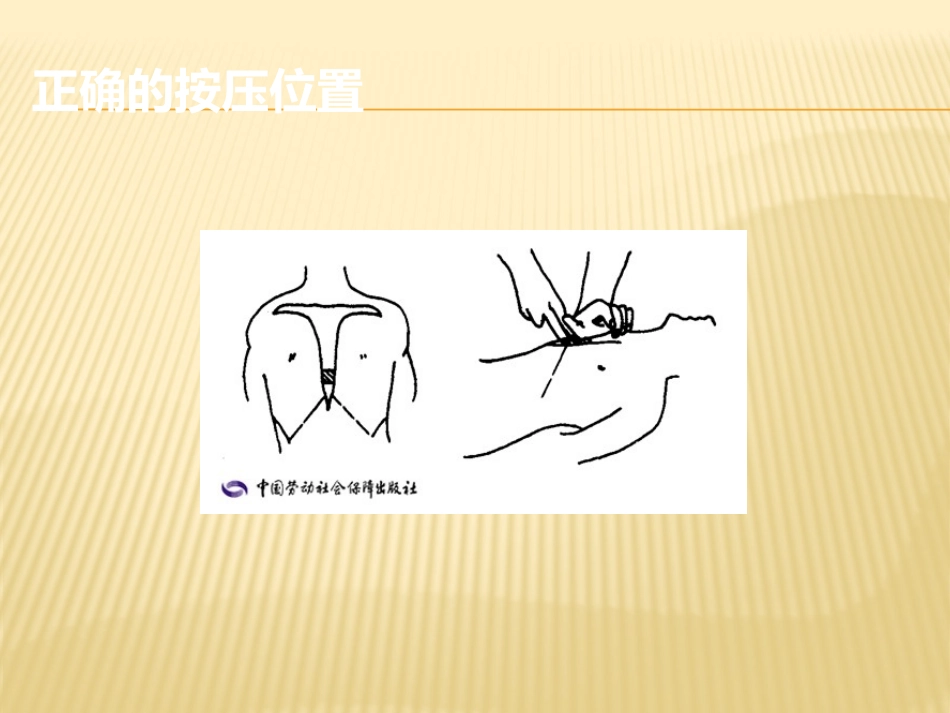 胸外心脏按压法_第3页