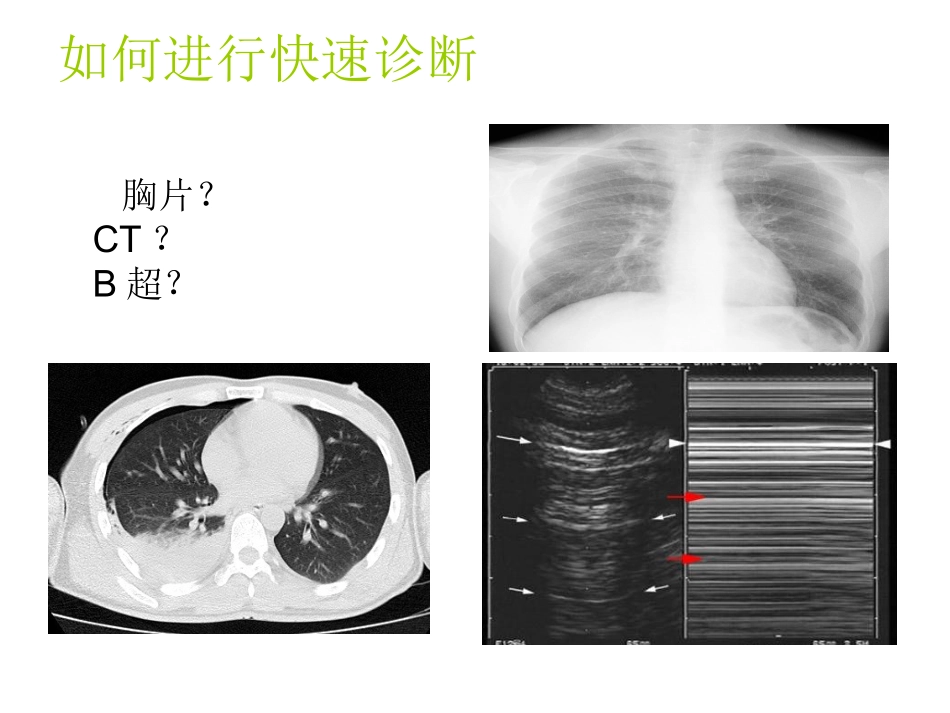 肺超声在重症监护室的应用_第3页