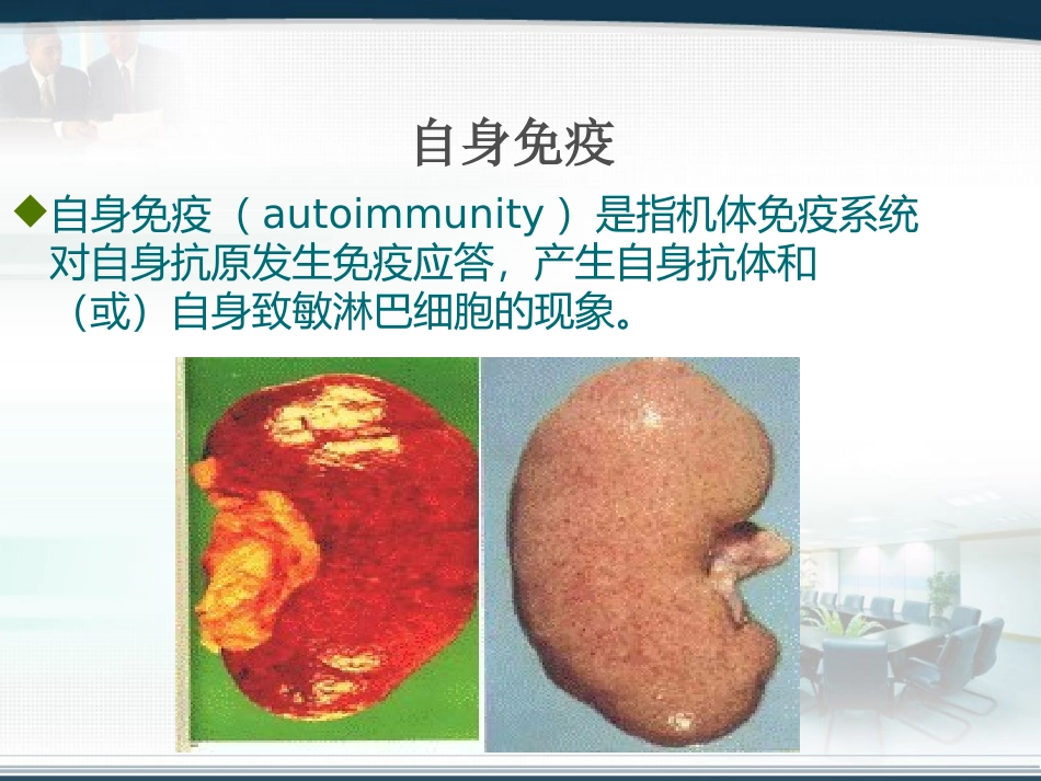 肺出血与肾炎综合征_第2页