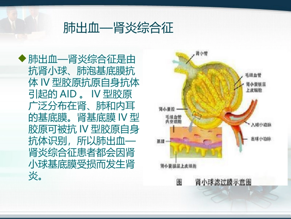肺出血与肾炎综合征_第3页