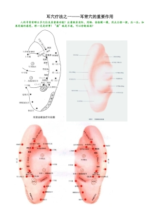 耳穴疗法之一