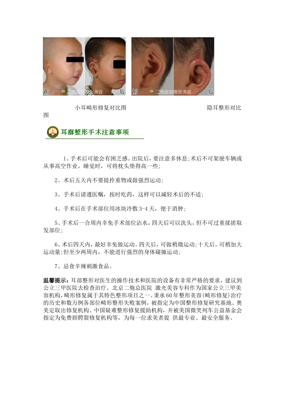 耳廓整形手术_第3页