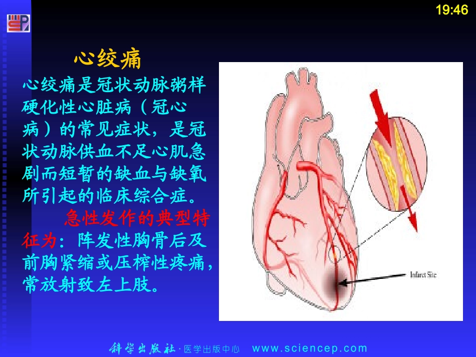 第四节抗心绞痛药_第3页