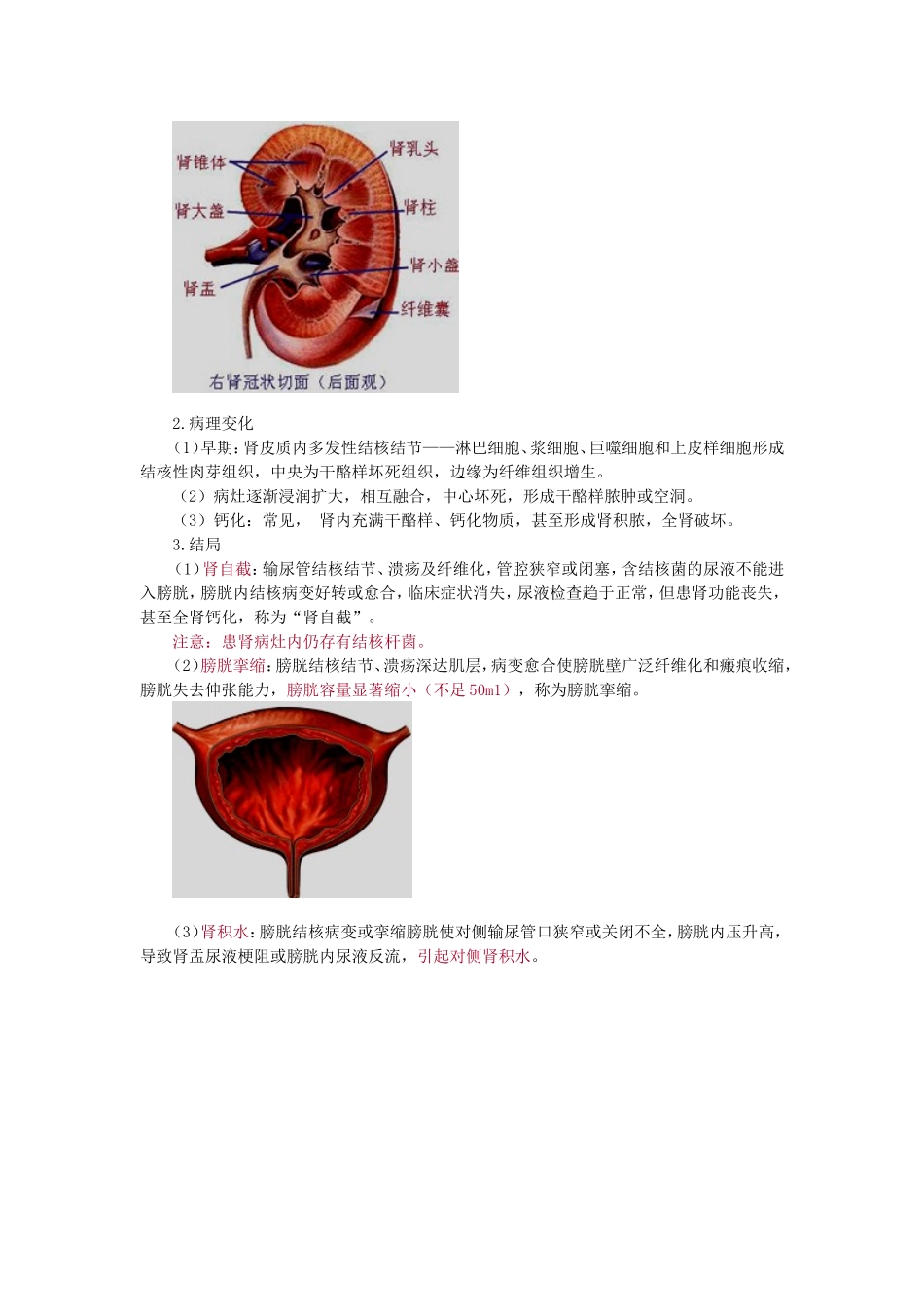 第五章 肾结核_第2页