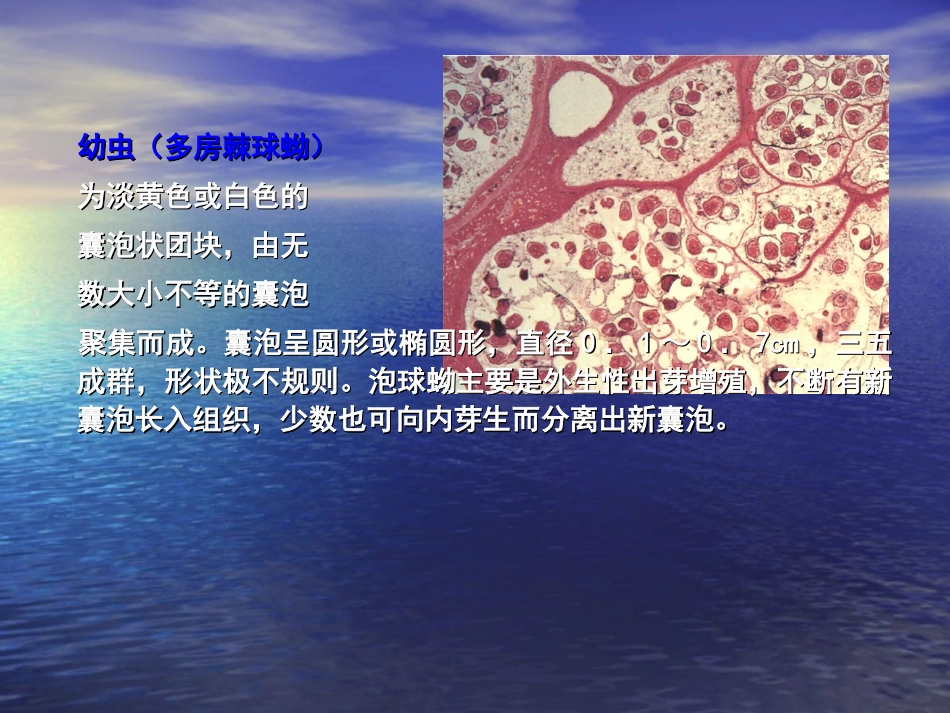 第七节 多房棘球绦虫_第3页
