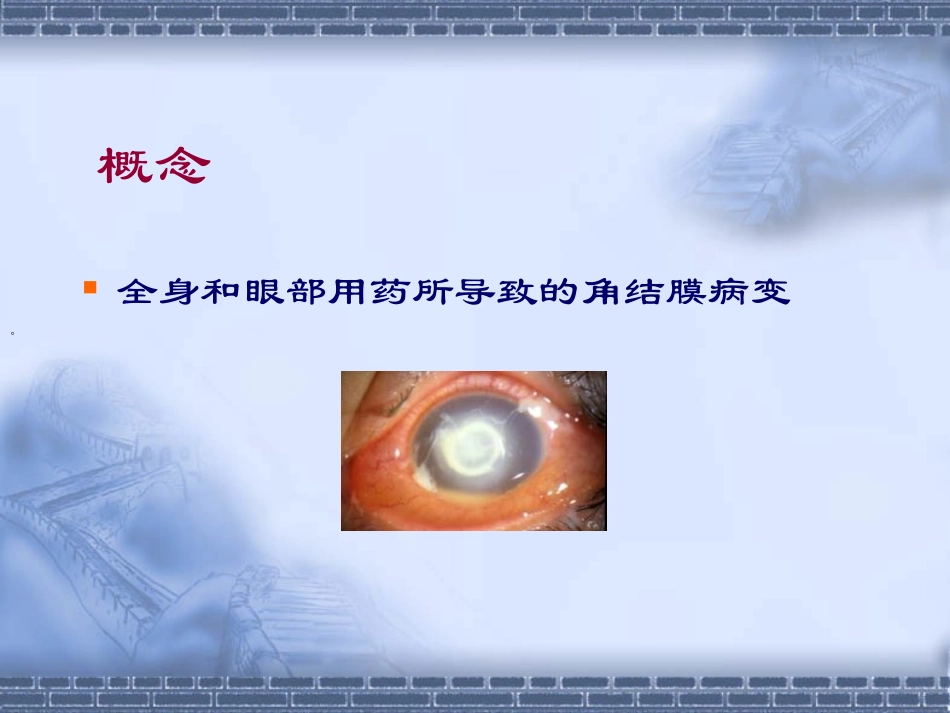 眼睑真菌病合并霰粒肿病一例_第2页