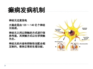 癫痫的发病机制