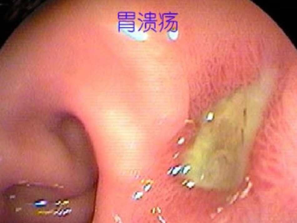 消化系统药用植物_第2页