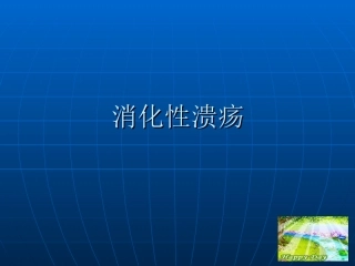 消化性溃疡2