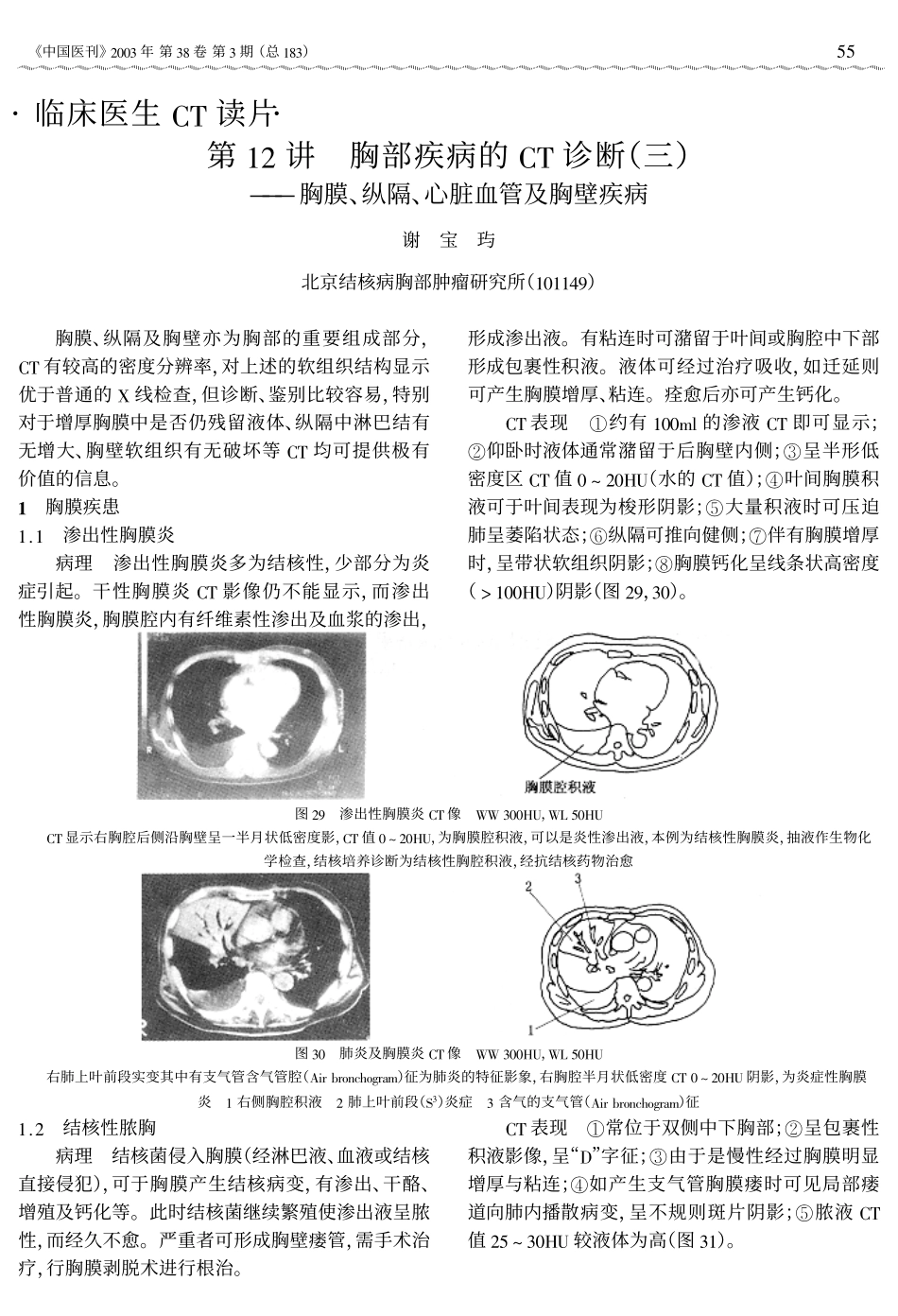 断三胸膜、纵隔、心脏血管及胸壁疾病_第1页