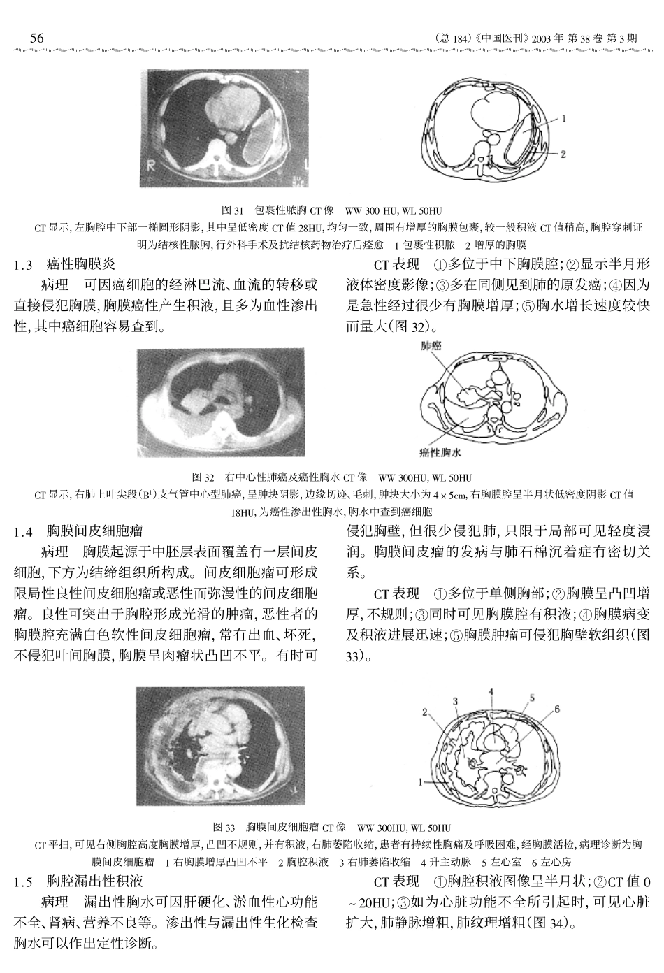 断三胸膜、纵隔、心脏血管及胸壁疾病_第2页