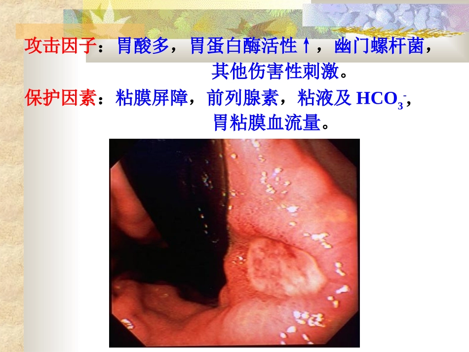 抑制胃酸分泌_第3页