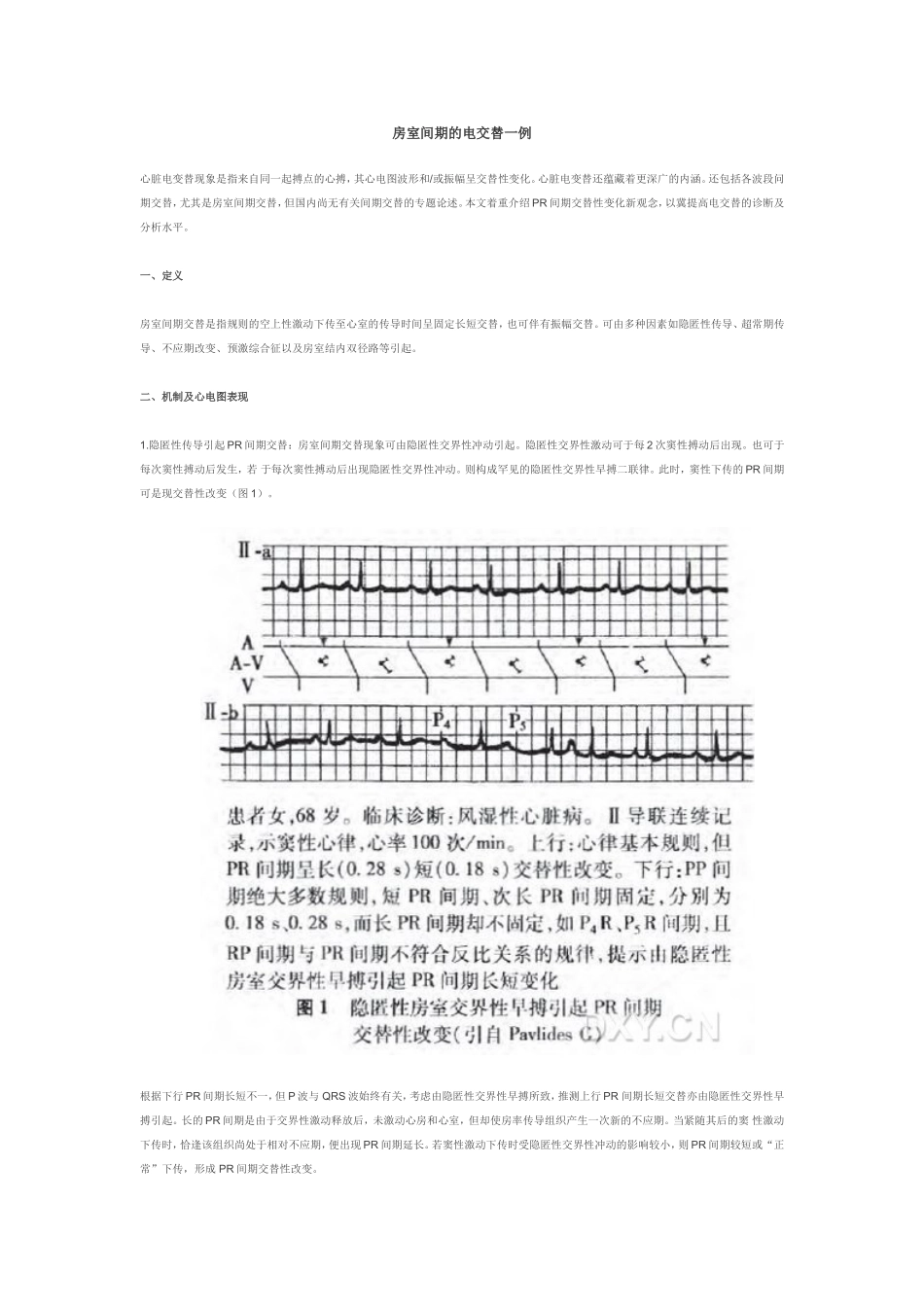 房室间期的电交替一例_第1页