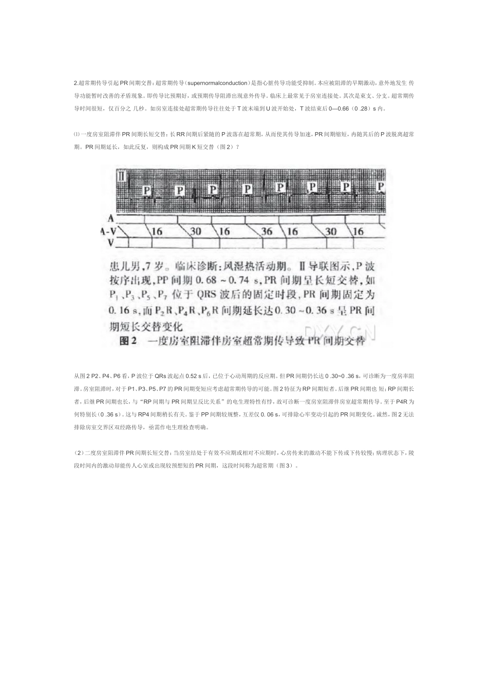 房室间期的电交替一例_第2页