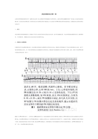 房室间期的电交替一例